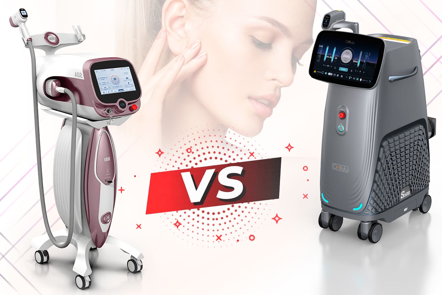 BBL апарат чи діодний лазер: що вибрати?