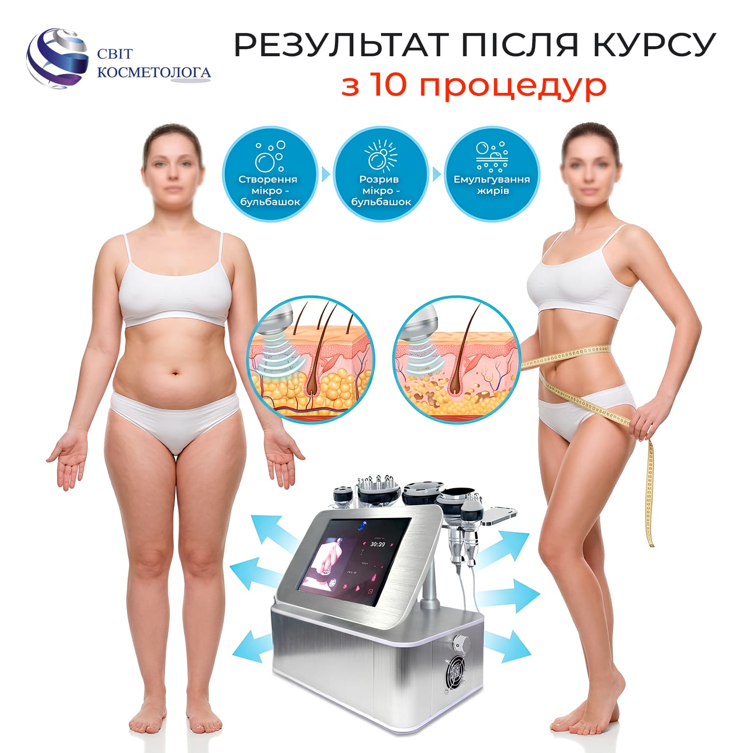 Ожидаемые результаты на аппарате кавитации S-04