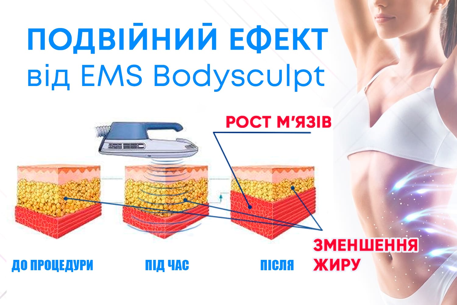 Ефект від EMS-терапії
