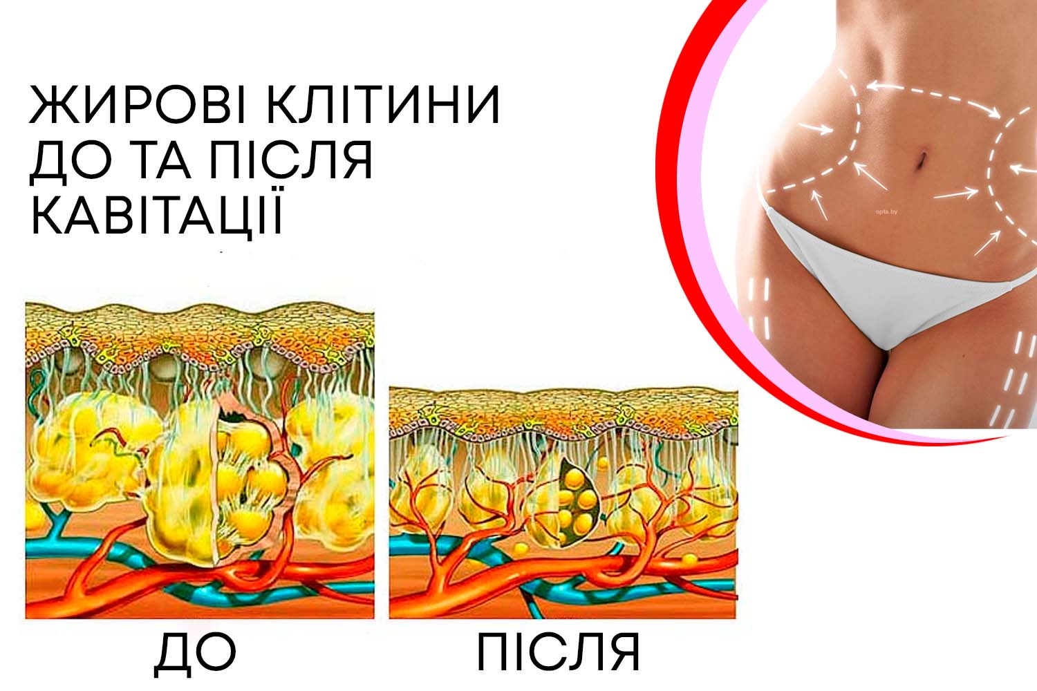 Воздействия на жировую ткань