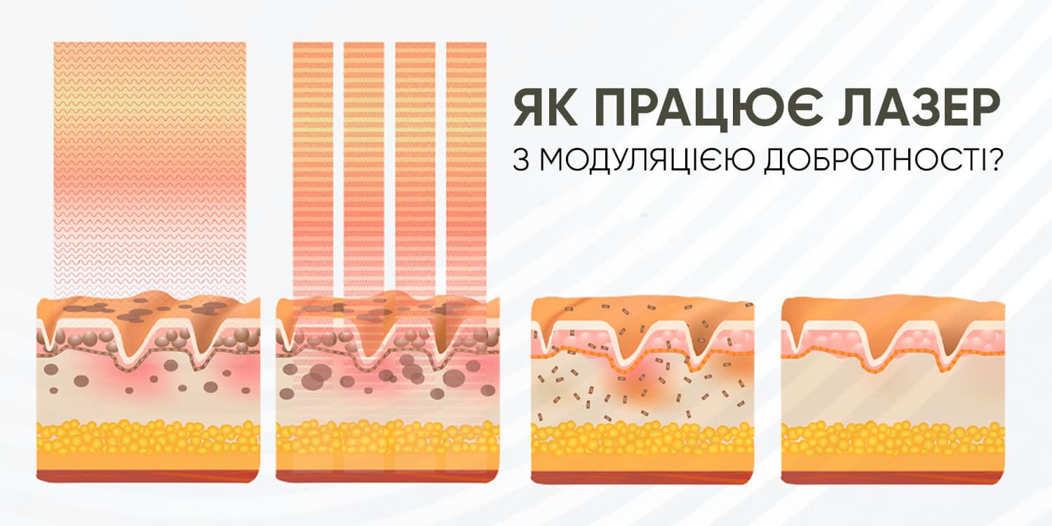 Модуляція добротності LIFFAN Q6