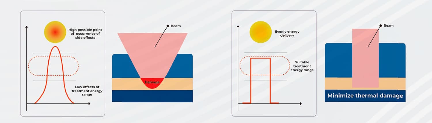Відсутність деформації світлової плями